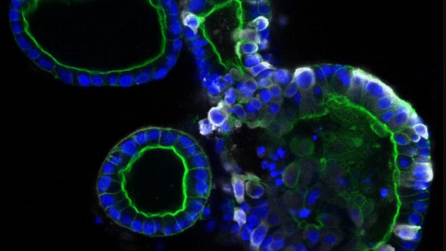 Covid-19 no intestino